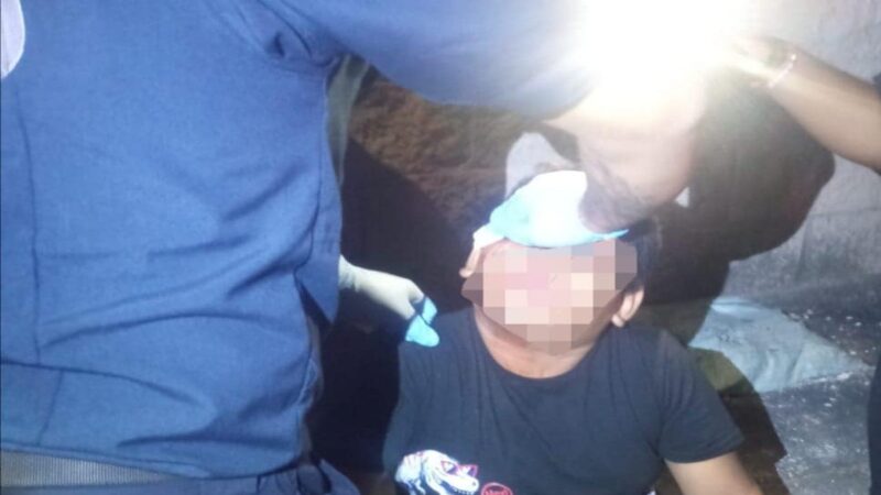 Perro muerde en la cara a un niño en Playa del Carmen.