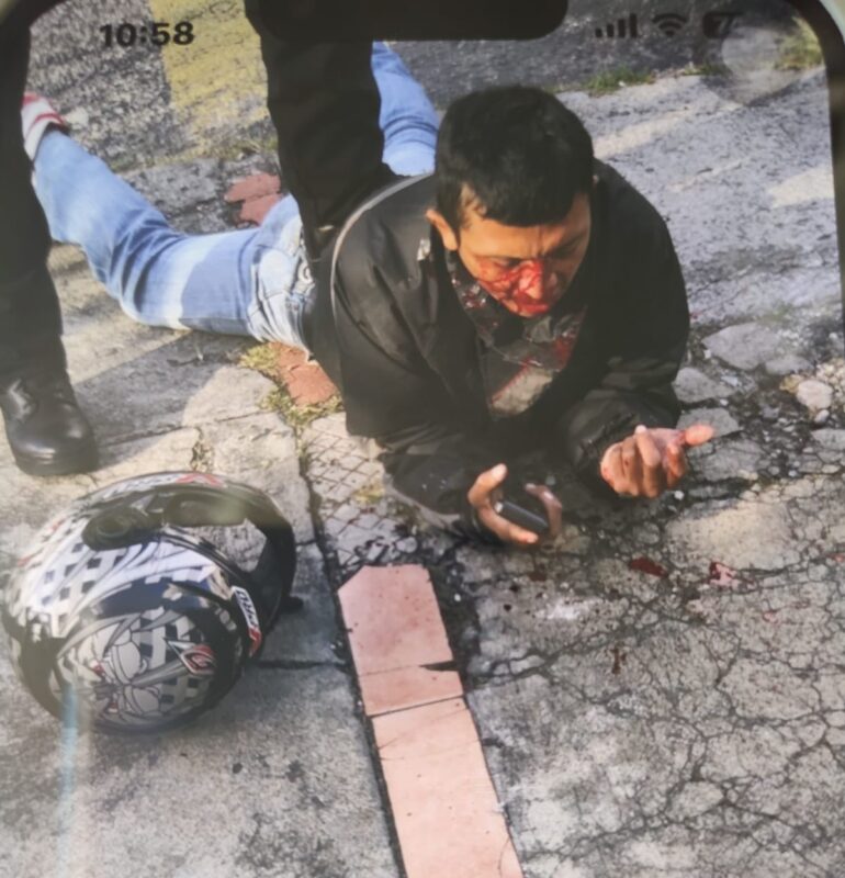 Ladrones intentan robar a pareja y él se defiende a golpes; uno de los delincuentes terminó con la cara rota y sangrante.