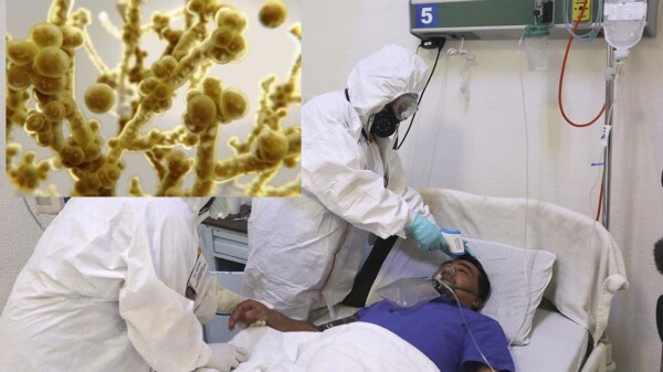 Propagación de hongo mortal causa preocupación en Estados Unidos