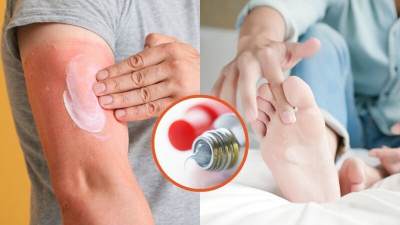 Estos famosos ungüentos podrían representar un riesgo para su salud.