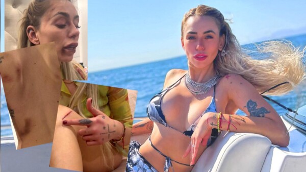 Periodista de Televisa acusa golpiza de policías de Queretaro