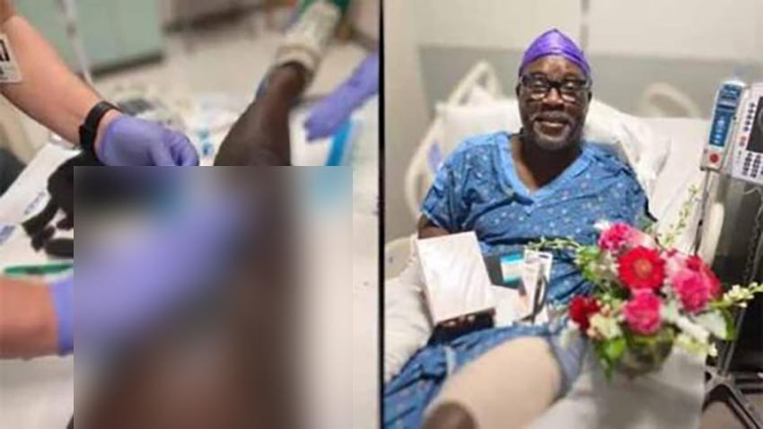 Contrae bacteria carnívora tras ser mordido en una pierna por un familiar; lo de Donnie Adams se convirtió en una situación de vida o muerte.