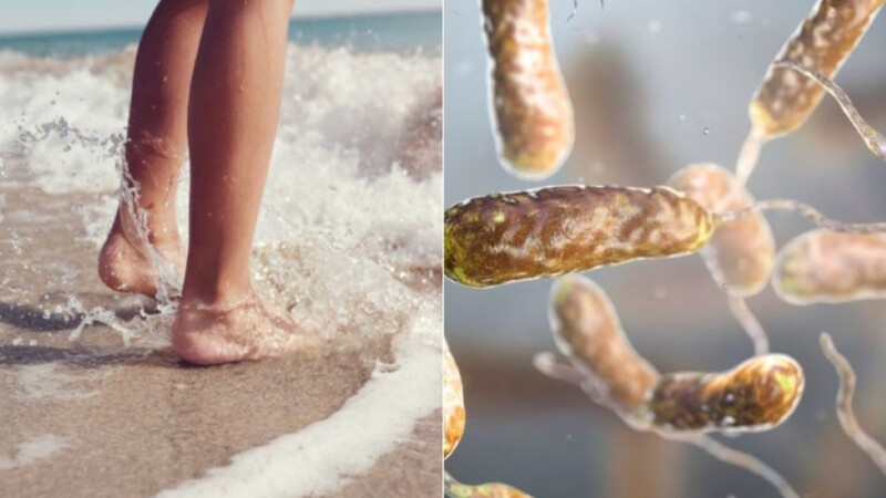 Alertan la presencia de la bacteria ‘come carne’ en aguas del Atlántico y el Golfo de México