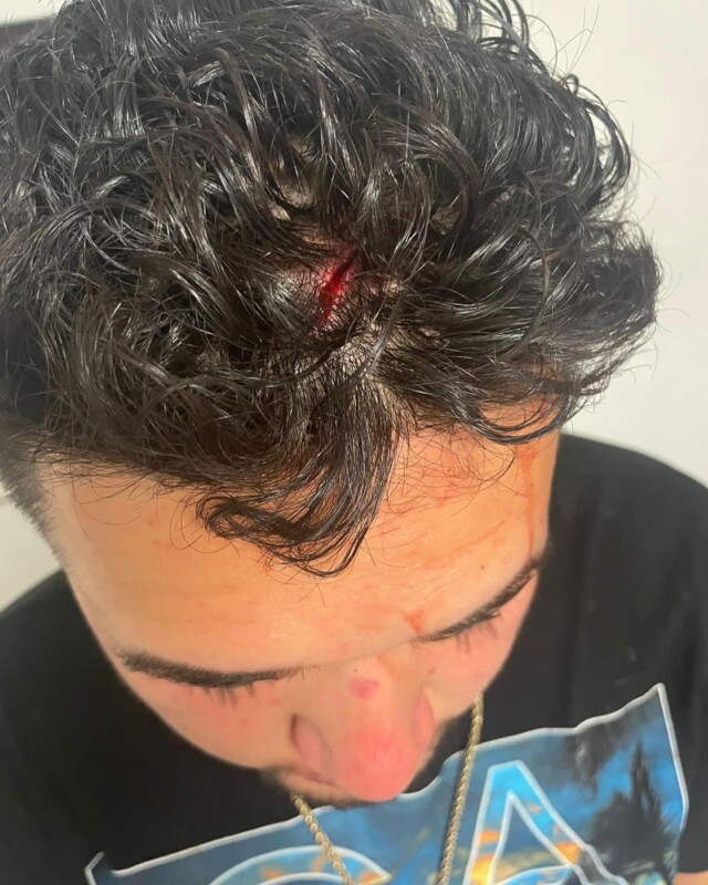 Fan de Santa Fe Klan acusa al equipo de seguridad del cantante de golpearlo