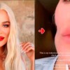 Le quitan tumor cancerígeno a Khloe Kardashian