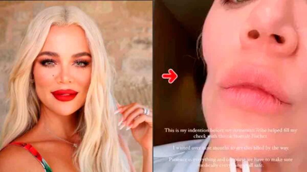 Le quitan tumor cancerígeno a Khloe Kardashian