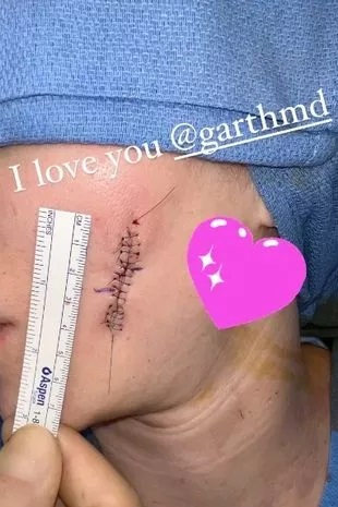 Le quitan tumor cancerígeno a Khloe Kardashian