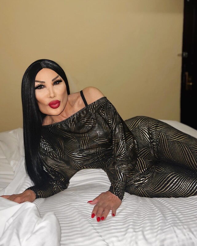 "Me dejó ahí, el baboso": Lyn May acusa a bailarines de provocar su caída