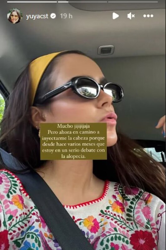 ¡Esta quedando pelona! Yuya revela sufrir alopecia