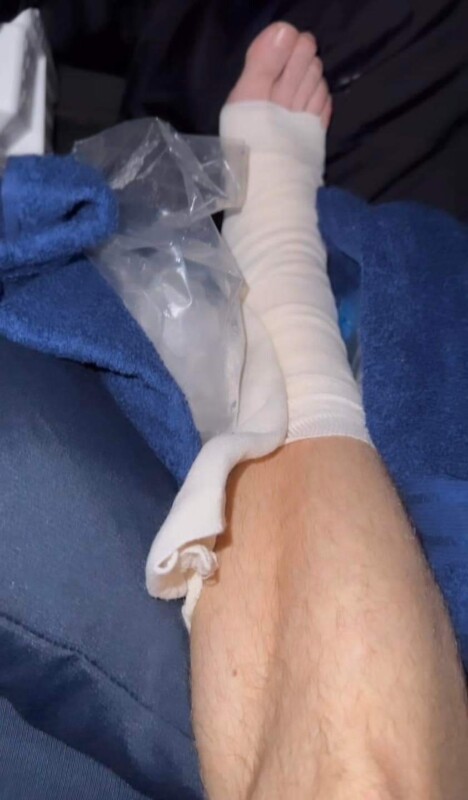 Jay de la Cueva sufre accidente durante concierto de Moderatto en Pachuca