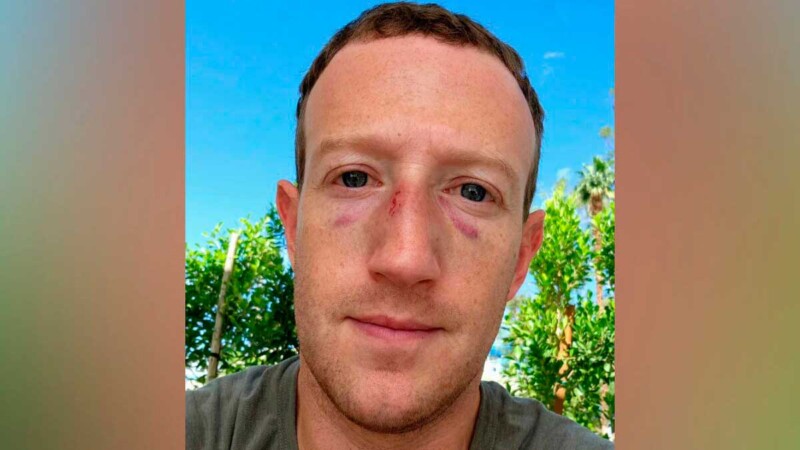 Mark Zuckerberg, CEO de Meta, aparece con golpes en la cara
