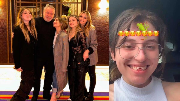 Regina Castro, hija de Angélica Rivera, sufre accidente y termina sin dientes