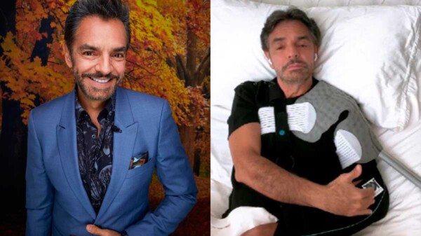 Eugenio Derbez estuvo apunto de perder el brazo tras accidente