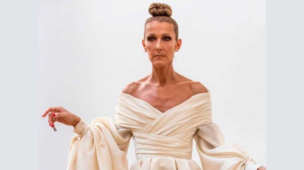Céline Dion perdió control de sus músculos