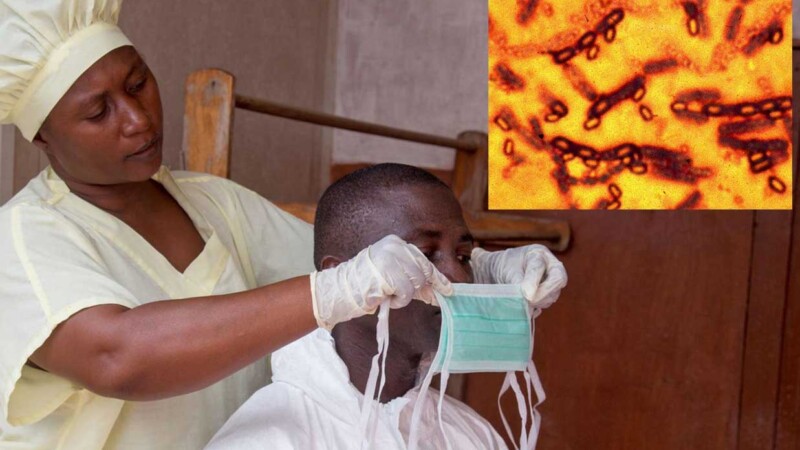 Brote de ántrax en África enciende las alarmas de la OMS