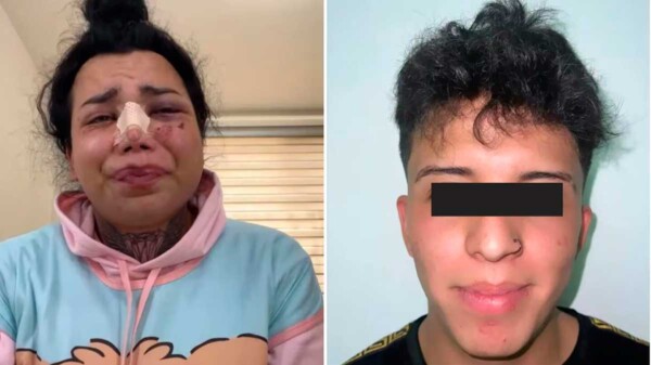 Paola Suárez perdonó a su prometido tras golpiza