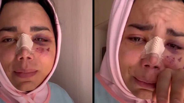 Paola Suárez rompe en llanto al recordar el ataque de su novio