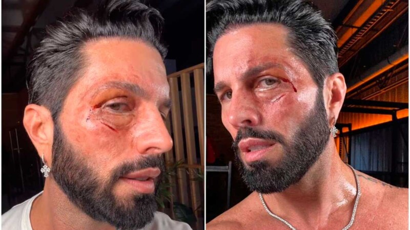 ¿Qué le pasó? Poncho de Nigris aparece con el rostro golpeado