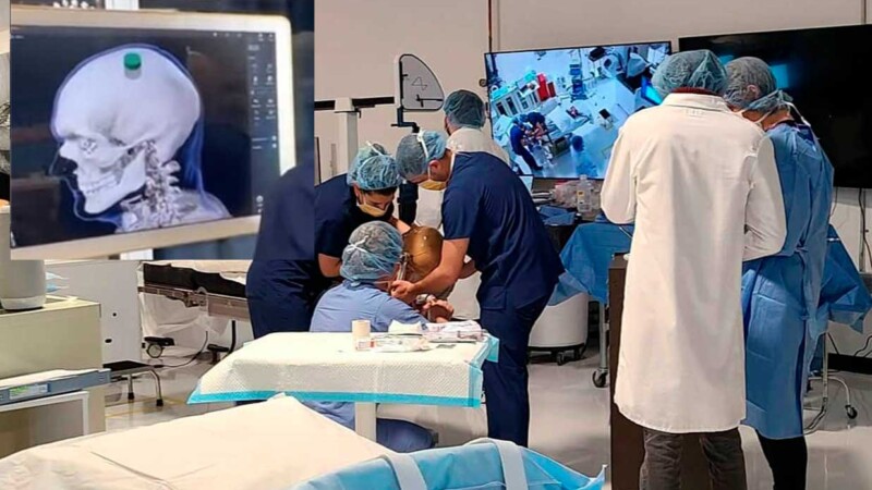 Neuralink implantó ya el primer chip cerebral, asegura Elon Musk