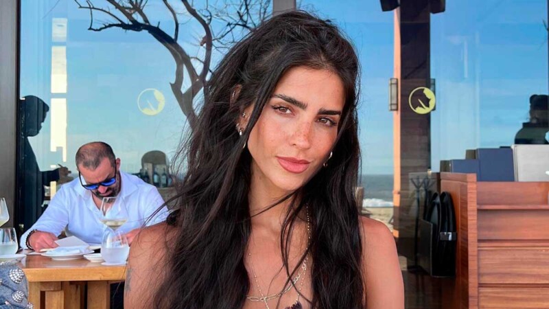 Bárbara de Regil sufre fuerte quemadura en la piel