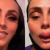 Ivonne Montero aparece con el labio inflamado en redes sociales