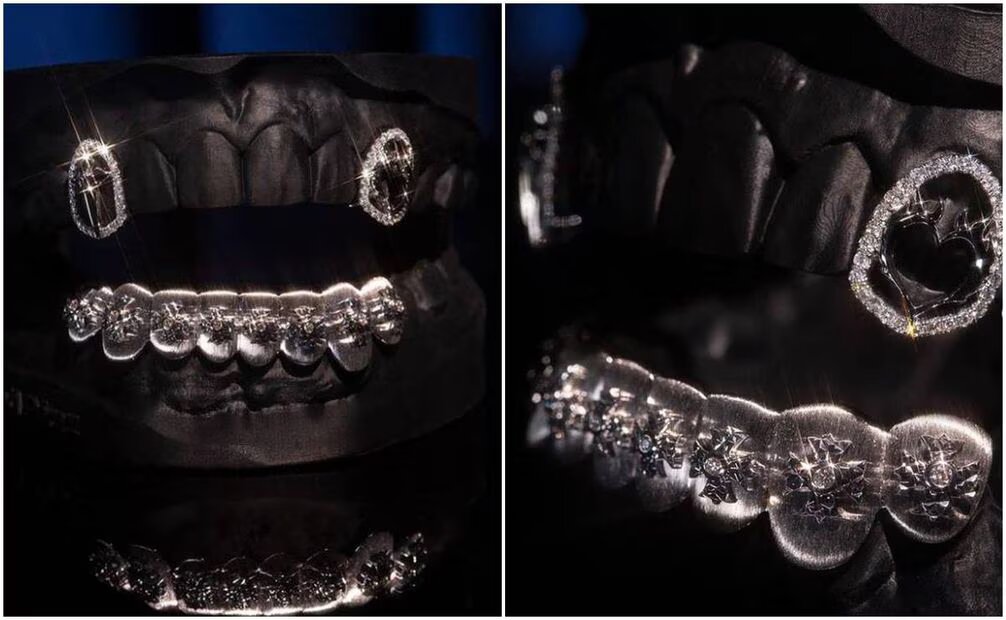 Christian Nodal se arrepiente de reemplazar algunos dientes por diamantes