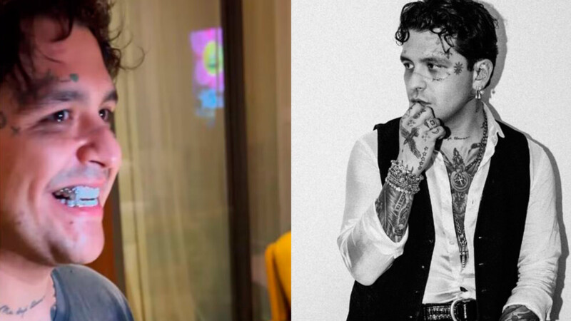 Christian Nodal se arrepiente de reemplazar algunos dientes por diamantes