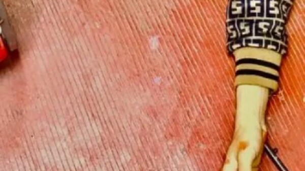 Presunto asaltante se dispara en la cabeza durante un asalto