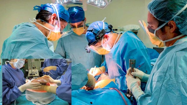  Paciente muere al extirparle el cirujano el hígado por error