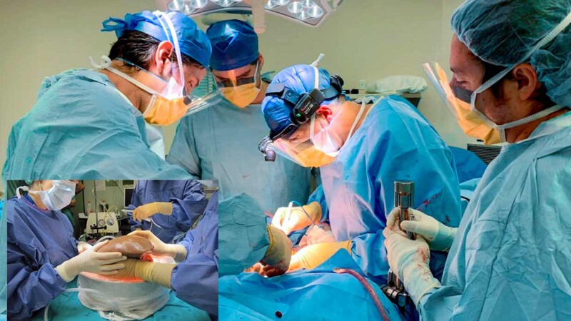  Paciente muere al extirparle el cirujano el hígado por error