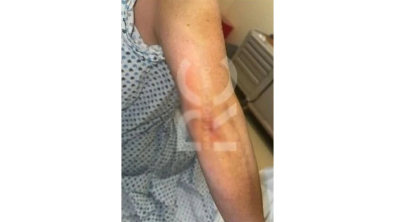 Filtran foto de Alicia Villarreal agredida por Cruz Martínez