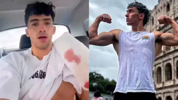 Influencer Gero Arias sufre grave accidente y pierde dos dedos