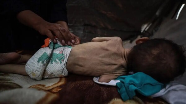 Gazatíes al borde de la hambruna