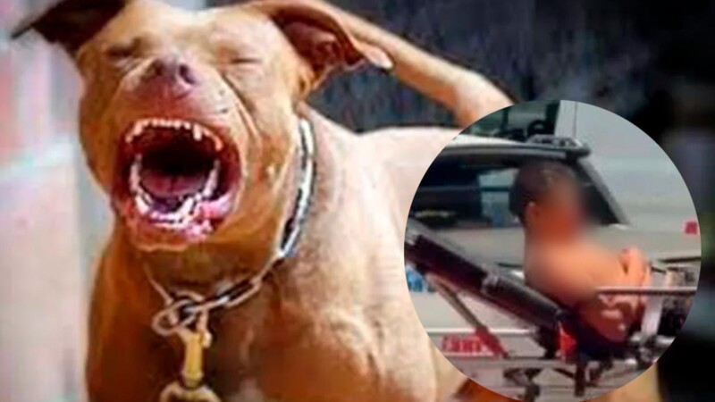 Perros pitbulls se rebelan contra su dueño en la CDMX y lo atacan gravemente