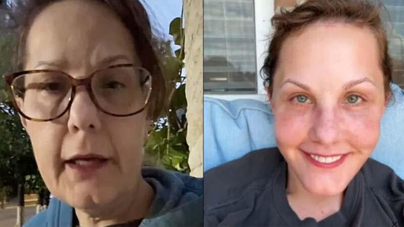 Mujer de 50 años se somete a cirugía estética en México y en redes creen que “parece de 26”