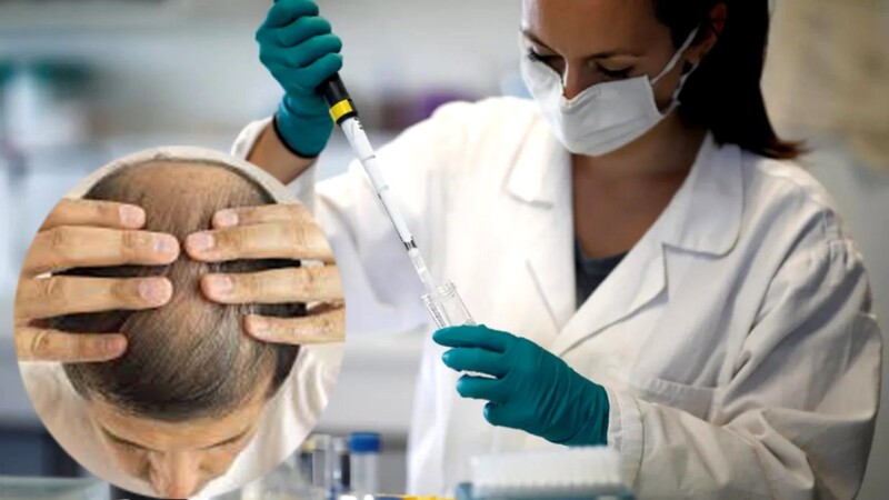 Científicos de la UCLA descubren nueva molécula que reactiva el crecimiento del pelo