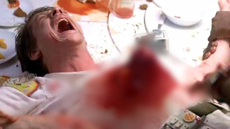 Como en película de Alien, médicos extraen una anguila viva del abdomen de un hombre