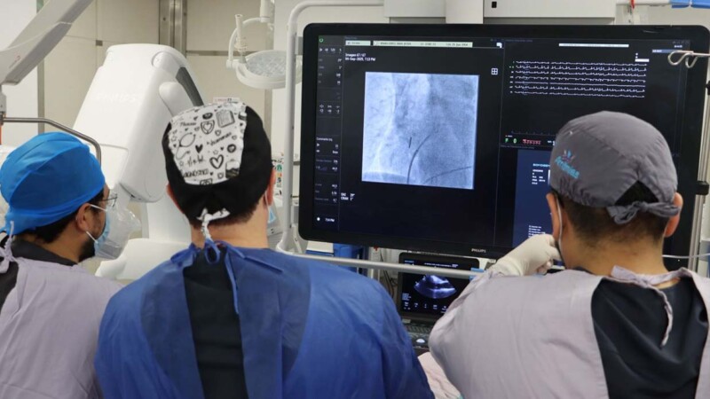 Se realiza con éxito técnica innovadora para tratar arritmia cardíaca en Hospital Regional de Alta Especialidad de Yucatán