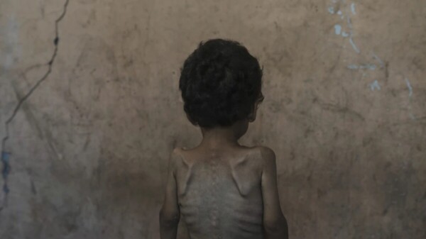 Cada día, 28 niños asesinados en Gaza