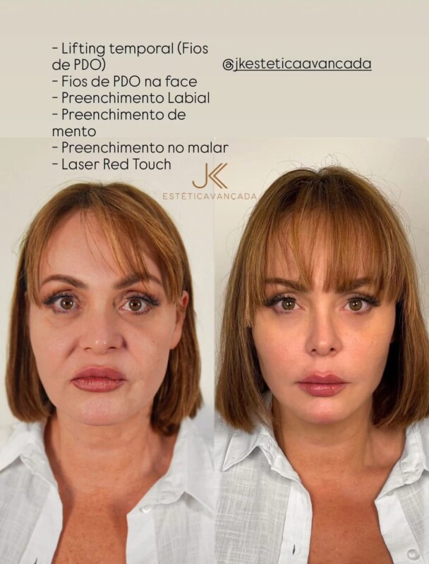 Gaby Spanic sorprende con radical transformación estética