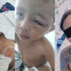 Menor de dos años es hospitalizado de emergencia en Cancún tras presunta golpiza de su padrastro