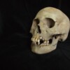 Hallan evidencia más antigua de la peste, de hace 5.500 años