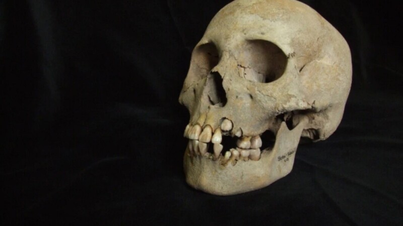 Hallan evidencia más antigua de la peste, de hace 5.500 años