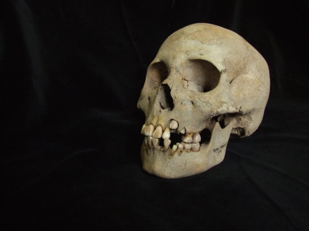 Hallan evidencia más antigua de la peste, de hace 5.500 años