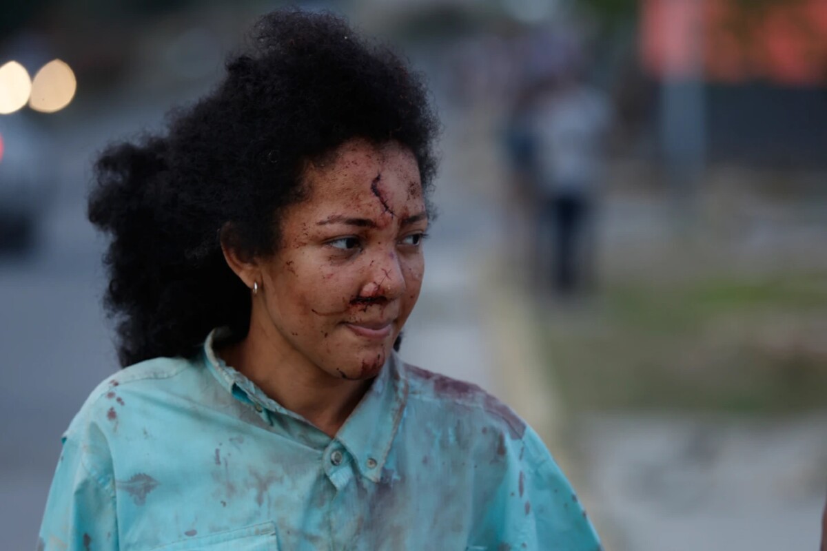 Una mujer herida camina por La Guaira, Venezuela, un día después de que un terremoto sacudiera la zona, el jueves 25 de junio de 2026. 