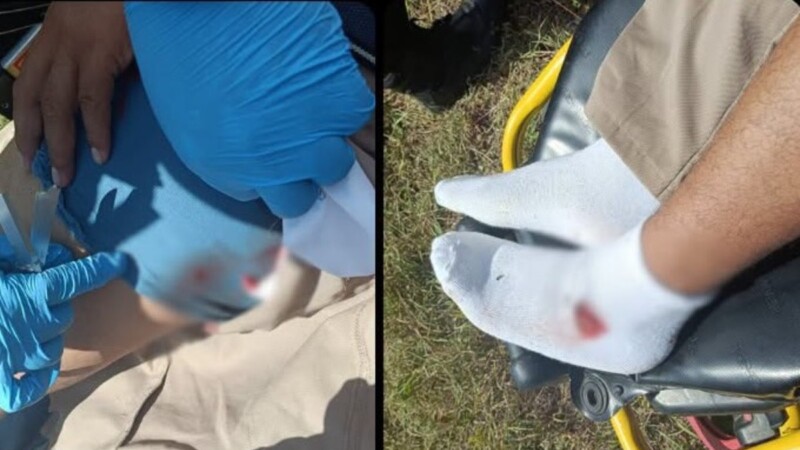 Lesionan con balines a motociclista en la carretera Tizimín-Río Lagartos