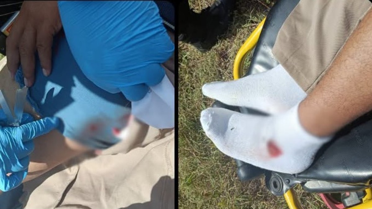Lesionan con balines a motociclista en la carretera Tizimín-Río Lagartos