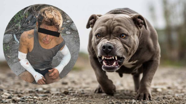 Pitbull lesiona a presunto ladrón que ingresó a una propiedad en Yucatán